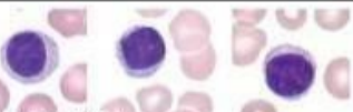 <p>What lymphocytes?</p>