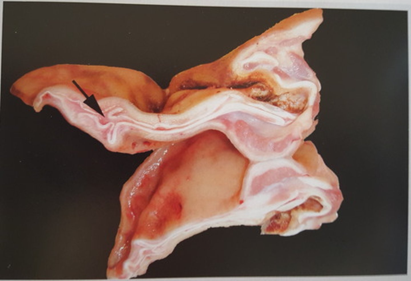 <p>Øre fra svin. Patoanatomisk diagnose?</p>