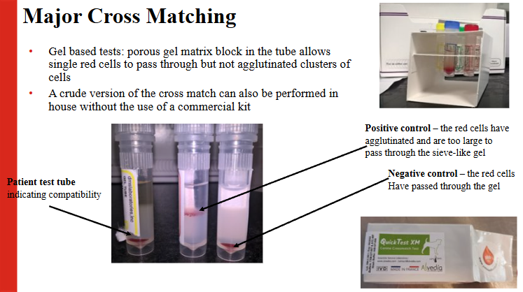 <p>Major - check recipient plasma for alloantibodies against donor erythrocytes</p><p>Minor - check donor plasma for alloantibodies against recipient erythrocytes. This can be used when using non-cellular products</p>