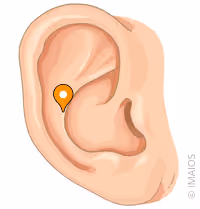 <p>what part of the ear is this</p>