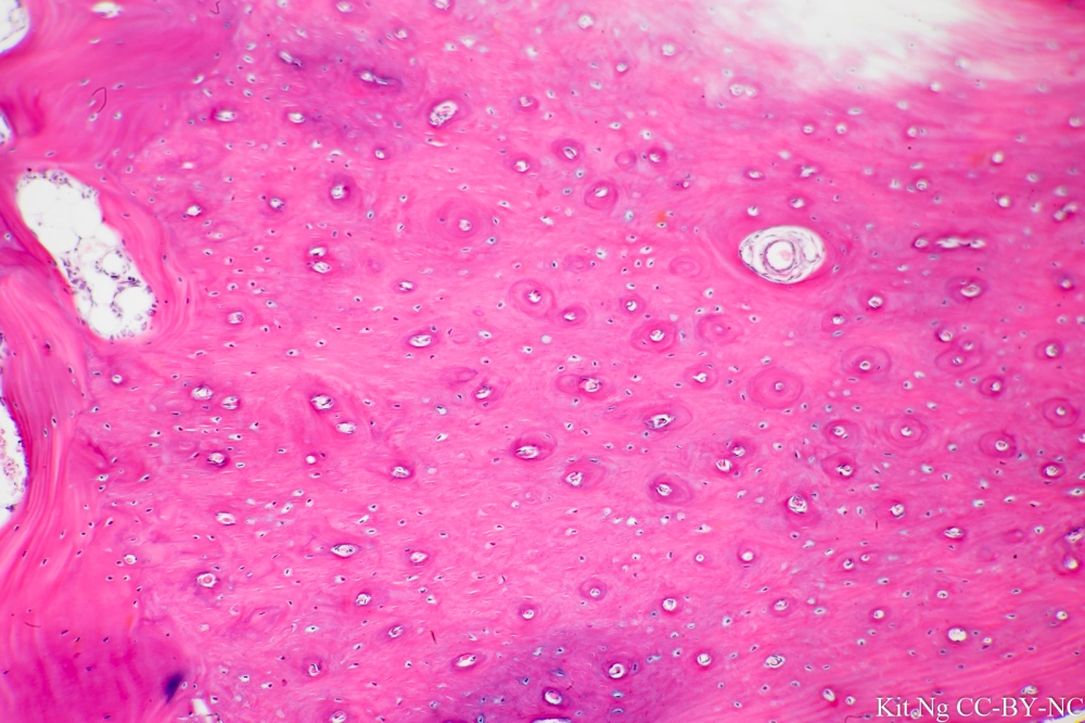 <p>fibrocartilage </p>