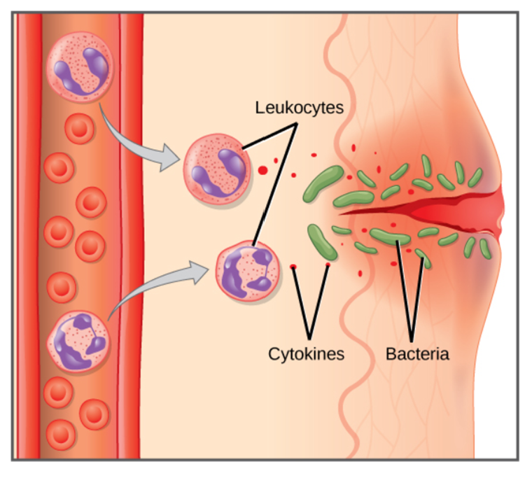 <ul><li><p><span>A pathogen stimulates an increase in blood flow to an infected area</span></p></li><li><p><span>Blood vessels in the area expand - vasodilation</span></p></li><li><p><span>White blood cells leak into the tissue from the vessels to invade the infected tissue</span></p></li><li><p><span>WBC (phagocytes) can then engulf and destroy bacteria</span></p></li><li><p><span>This all causes a red, swollen, painful inflammatory response</span></p></li></ul><p></p>