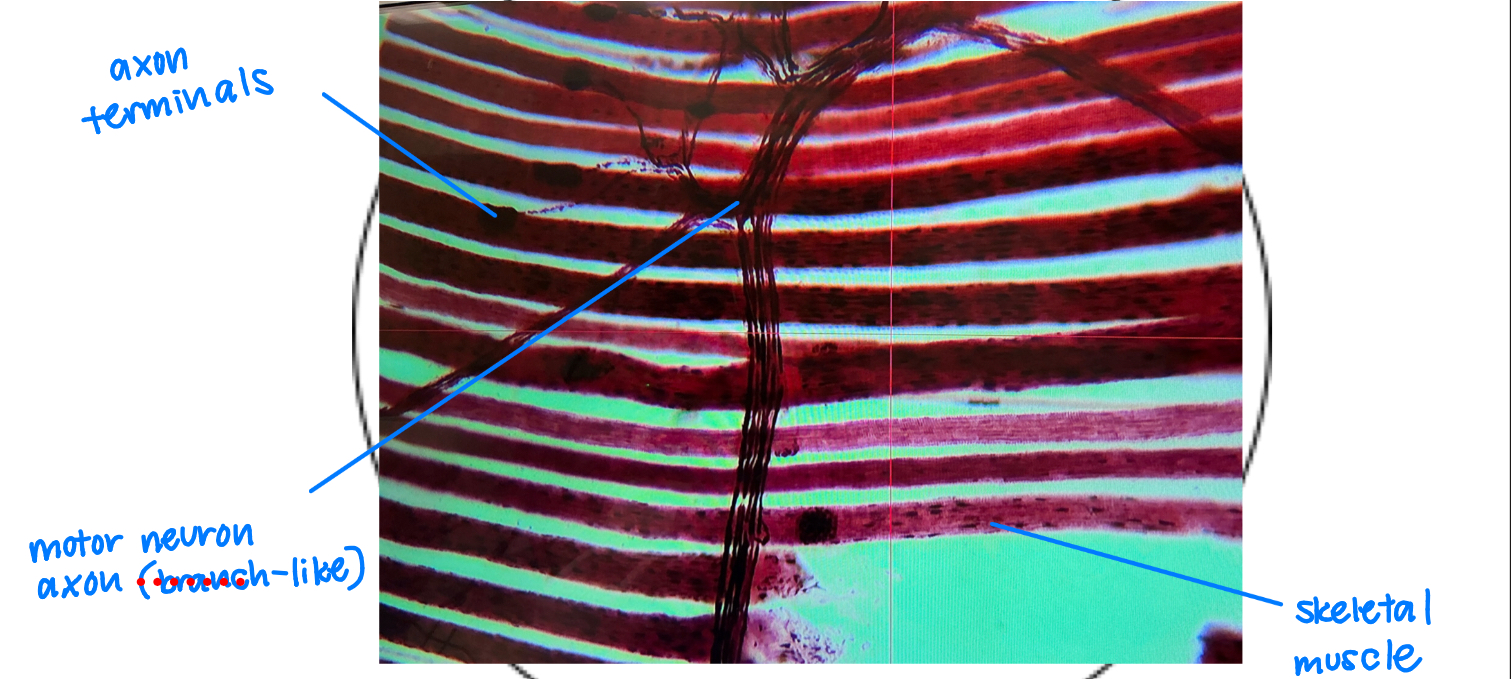 <ul><li><p>axon terminals: black dots</p></li><li><p>motor neuron axon: branch-like</p></li><li><p>skeletal muscle: lines of red/pink</p></li></ul><p></p>