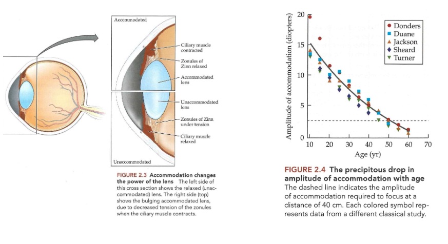 <ul><li><p>om ver beeld op netvlies te focussen → brekingsvermogen van de 4 optische componenten van oog moet perfect afgestemd zijn op lengte van oogbol</p><ul><li><p>optische componenten:</p><ul><li><p>hoornvlies</p></li><li><p>kamerwater</p></li><li><p>lens</p></li><li><p>glasvocht</p></li></ul></li><li><p>hoornvlies is sterk gebogen &amp; heeft hogere brekingsindex dan lucht → krachtigste brekende oppervlak in oog</p></li><li><p>kamerwater &amp; glasvocht helpen ook bij breken van licht</p></li></ul><p>→ brekingsvermogen van deze 3 = onveranderlijk → dus niet te gebruiken om dichtbijzijnde objecten scherp te stellen</p></li><li><p>lens → brekingsvermogen kan veranderen door van vorm te veranderen</p><ul><li><p>= accommodatie (verandering van focus)</p></li><li><p>bereikt door samentrekking van ciliarispier</p></li><li><p>lens via kleine vezels (ophangbanden = zonulae van Zinn) aan ciliarispier bevestigd</p><ul><li><p>ciliarispier ontspannen → zonulae uitgerekt → lens relatief plat</p><ul><li><p>oog zal dan scherpstellen op zeer verre objecten (bv. verre ster)</p></li></ul></li><li><p>ciliarispier trekt samen → minder spanning op zonulae → lens staat bol</p><ul><li><p>scherpstellen op iets dichterbij (bv. horloge/ smartphone)</p></li><li><p>hoe dikker lens → hoe meer ‘power’ → hoe dichterbij je kunt scherpstellen</p></li></ul></li></ul></li></ul></li><li><p>power van de lens (P) = 1/f</p><ul><li><p>f = brandpuntsafstand in meters</p></li><li><p>eenheid van power van de lens = dioptrie</p></li></ul></li></ul><p>→ vermogen om te accommoderen neemt af met leeftijd (± verlies van 1 dioptrie accommodatie per 5 jaar tot leeftijd van 30, en zelfs meer na leeftijd van 30)</p><ul><li><p>tegen tijd dat meeste mensen tussen 40-50 jaar oud zijn:</p><ul><li><p>niet makkelijk meer om 2,5 dioptrie te kunnen accommoderen die nodig is om scherp te zien op 40 cm</p></li><li><p>presbyopie = ouderdomsverziendheid → onvermijdelijk:</p><ul><li><p>lens wordt harder</p></li><li><p>kapsel dat lens omgeeft (&amp; waardoor lens van vorm kan veranderen) verliest elasticiteit</p></li></ul></li></ul></li></ul><p></p>