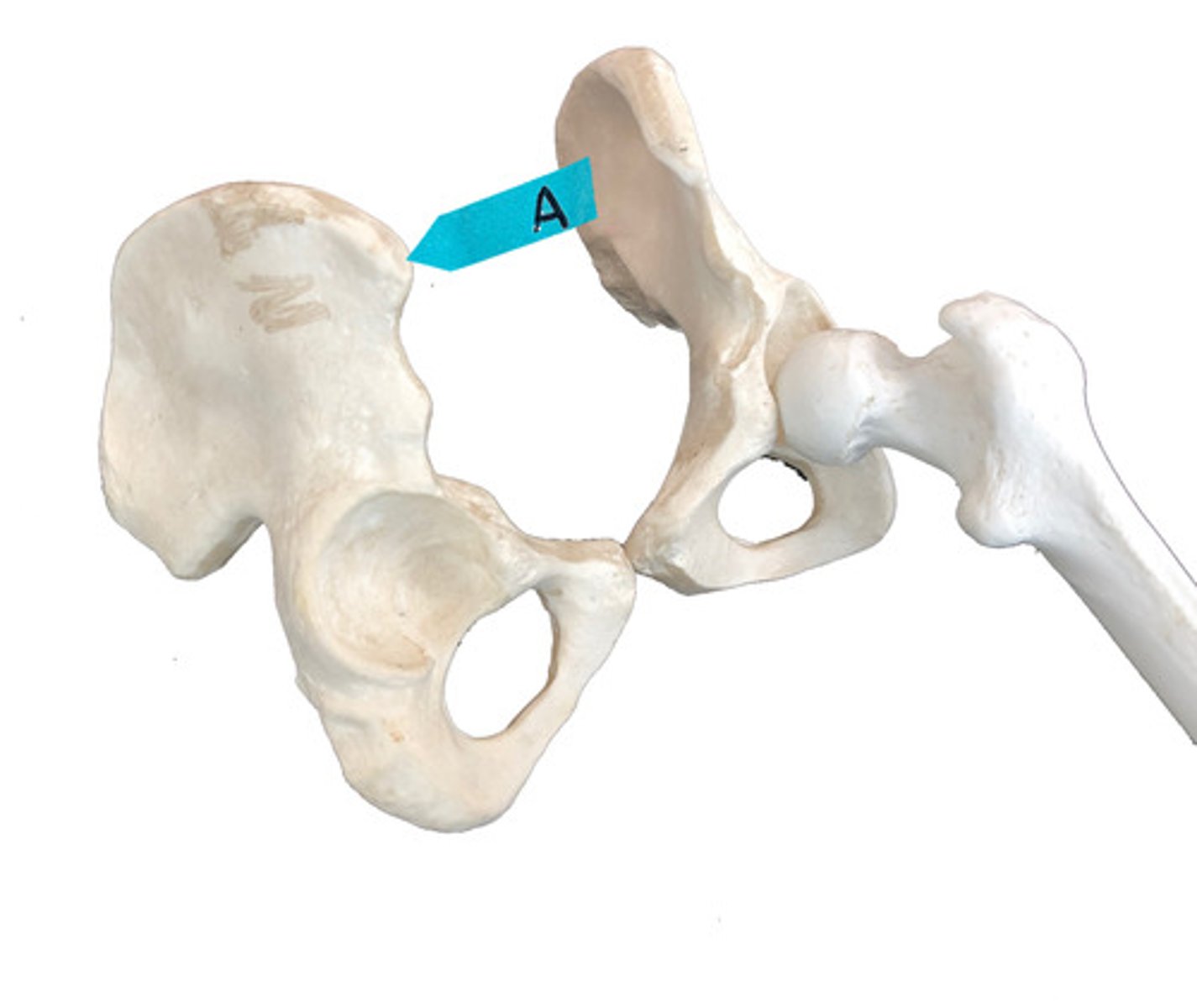 <p>Identify this bone marking.</p>