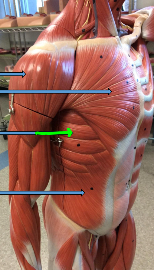 <p>Identify this muscle?</p>