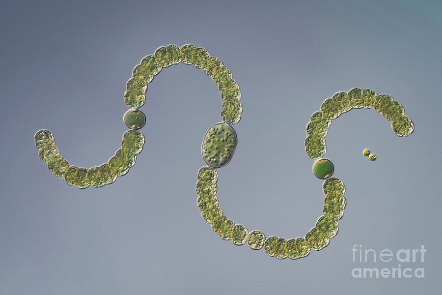 <p><span>The specimen above is an example of:</span><br>A. A fungus</p><p>B. A lichen</p><p>C. Bacteria cells</p><p>D. A plant</p>