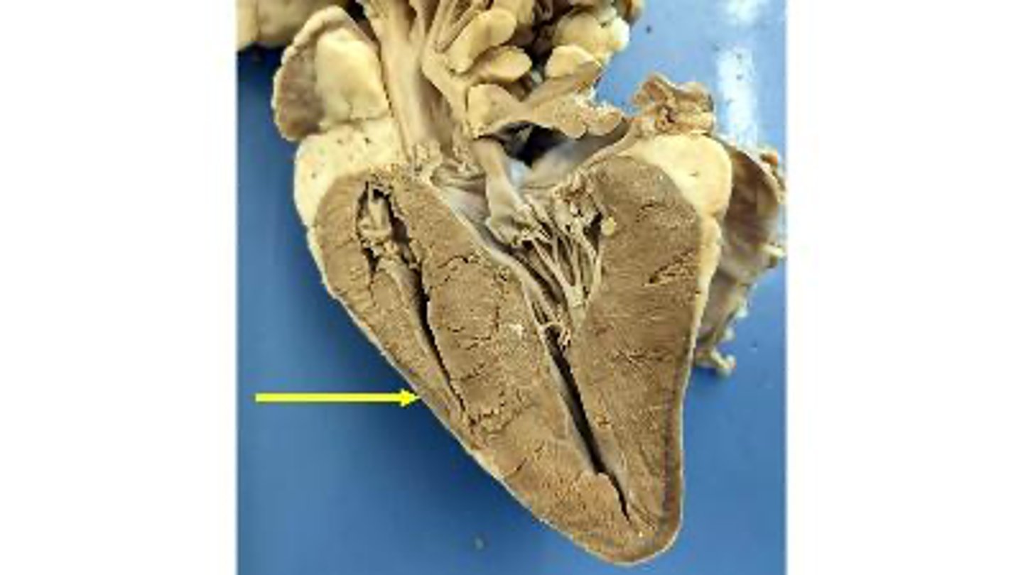 <p>Name the membrane</p>