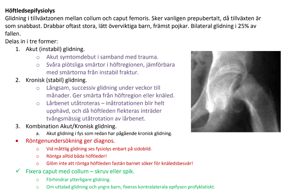 <p><strong>Troligaste diagnosen:</strong><br><span data-name="check_mark_button" data-type="emoji">✅</span> <strong>Fysiolysis capitis femoris (SCFE – Slipped Capital Femoral Epiphysis)</strong></p><p><strong>Motivering:</strong></p><ol><li><p class="ds-markdown-paragraph"><strong>Kliniska tecken</strong>:</p><ul><li><p class="ds-markdown-paragraph"><strong>Smärta i ljumske/lår med utstrålning till knä</strong> är klassisk för SCFE.</p></li><li><p class="ds-markdown-paragraph"><strong>Utåtrotering och nedsatt inåtrotation</strong> i höften är patognomoniskt.</p></li><li><p class="ds-markdown-paragraph"><strong>Övervikt och hypotyreos</strong> är kända riskfaktorer för SCFE.</p></li></ul></li><li><p class="ds-markdown-paragraph"><strong>Ålder</strong>: Vanligt hos pubertala barn (10–16 år).</p></li></ol><p></p>