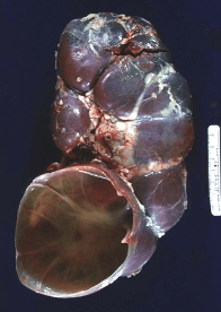 <p>Classify this lesion:</p><p>Cyst</p><p>Abscess</p><p>Polyp</p><p>Ulcer</p>