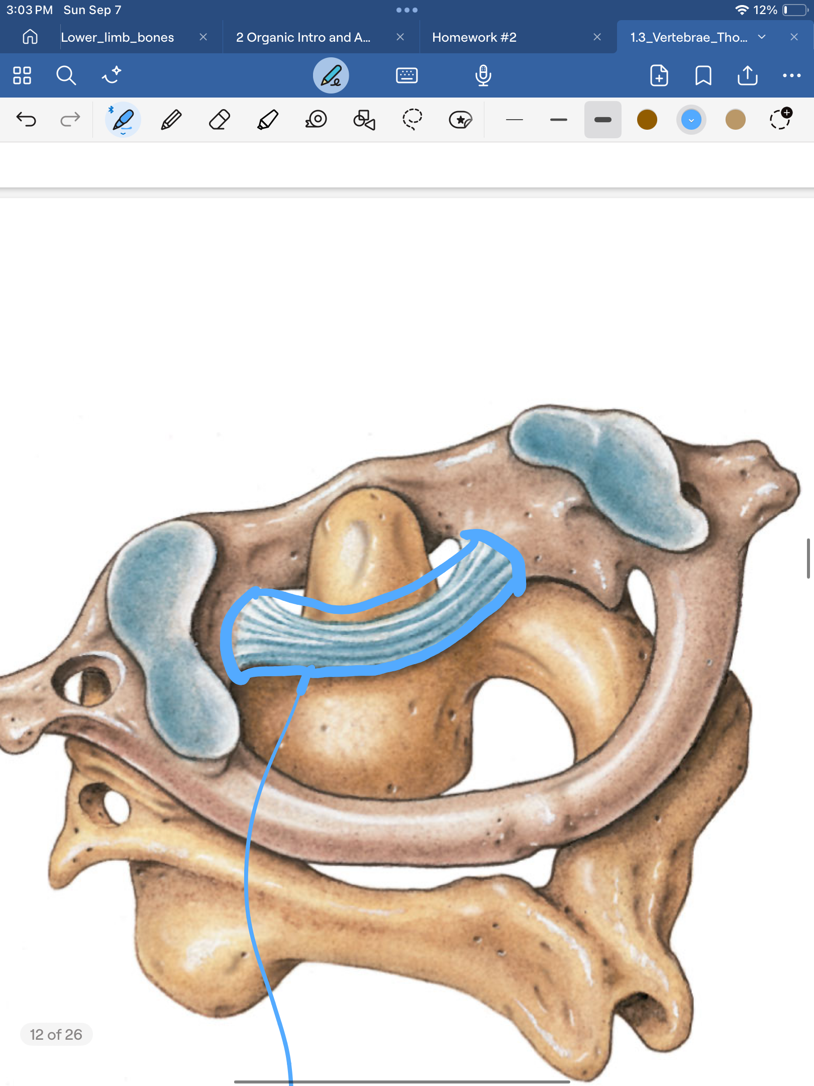 <p>What is the ligament in blue?</p>