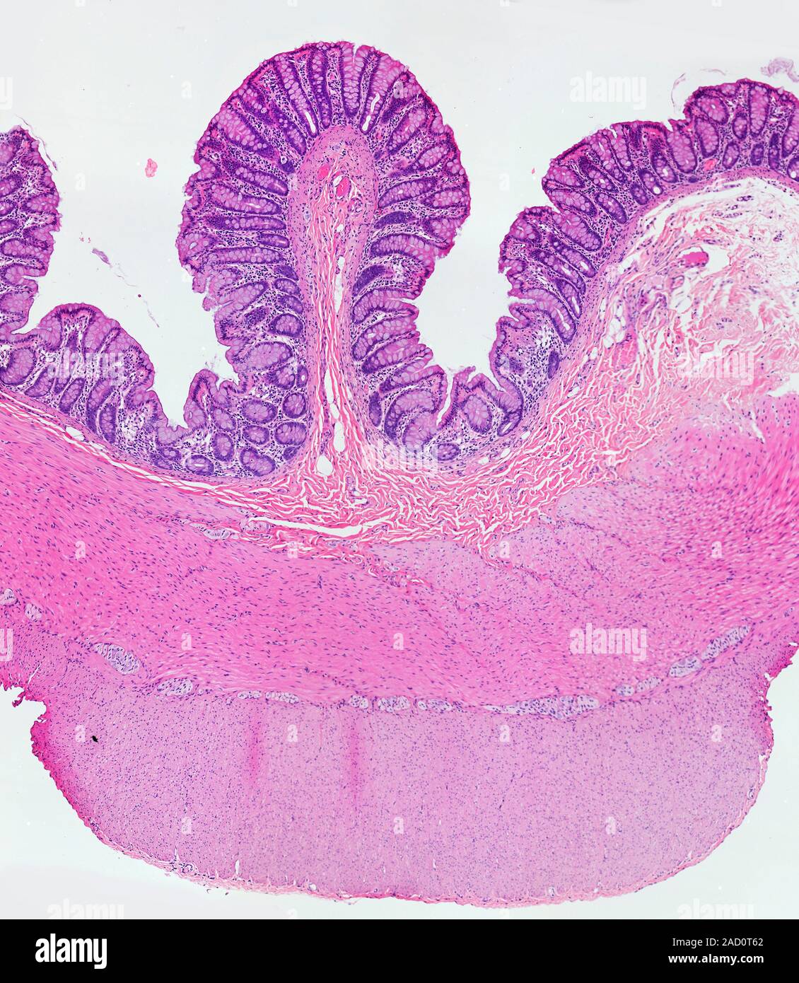 <p>Organ?</p><p>Bump looking structure on outside? Found where?</p>