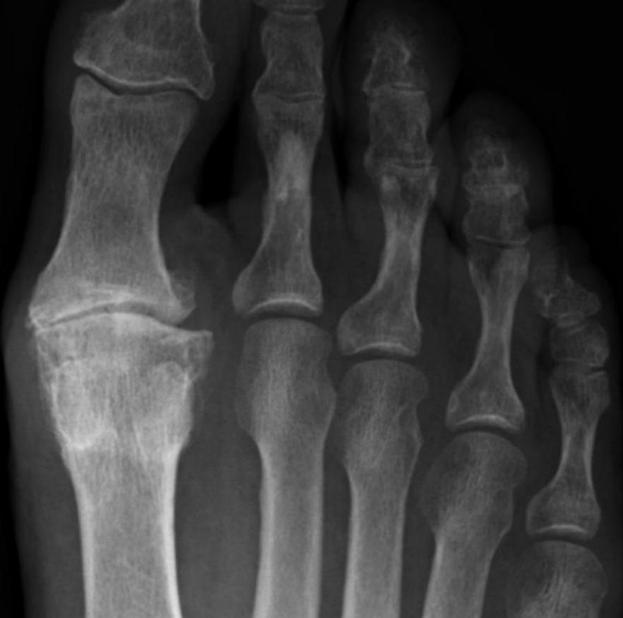 <p>describe the scan + indication</p>