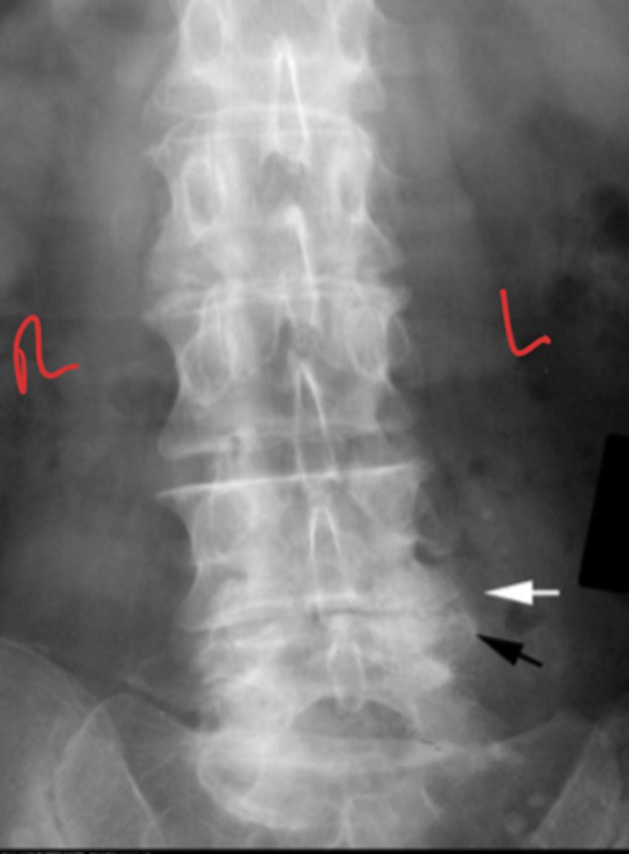 <p>What is the issue?</p>