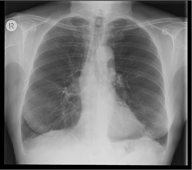 <p>What does this refer to </p>