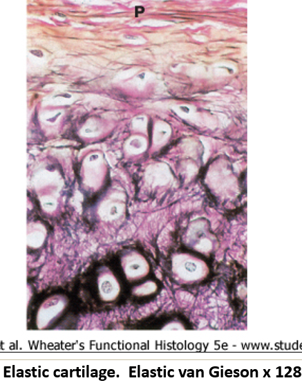 <p>Elastic cartilage </p>