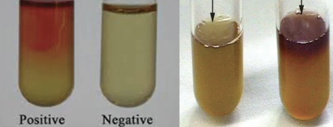 <p>What test is this?</p>