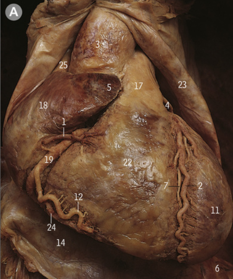 <p>What is the sulcus at 19?</p>