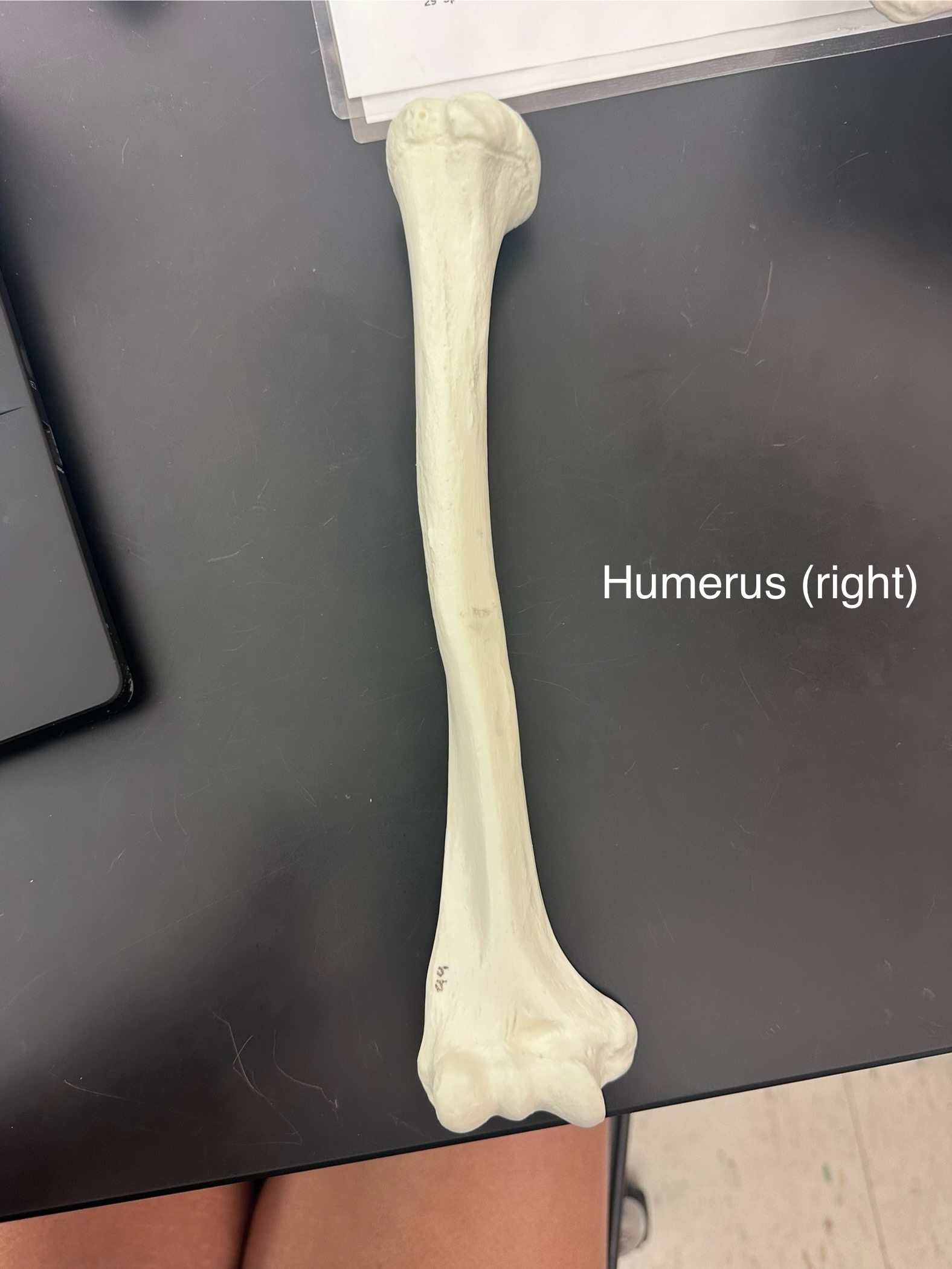 <p>Right humerus</p>