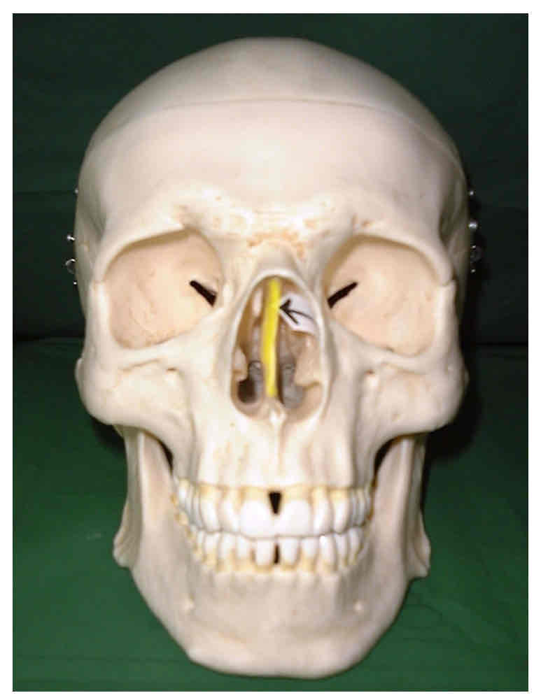 term image