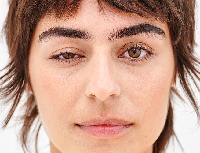 drooping of the upper eyelid caused by muscle paralysis and weakness