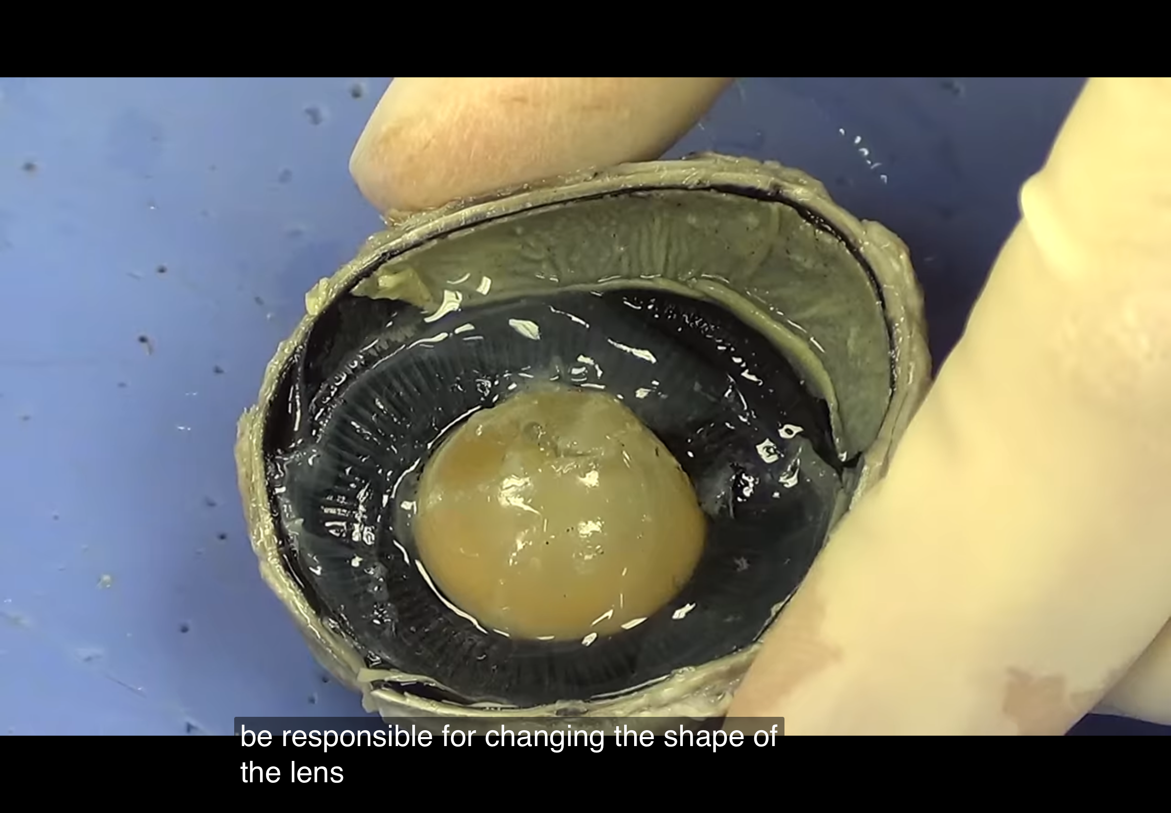 <p>Striated portion</p>