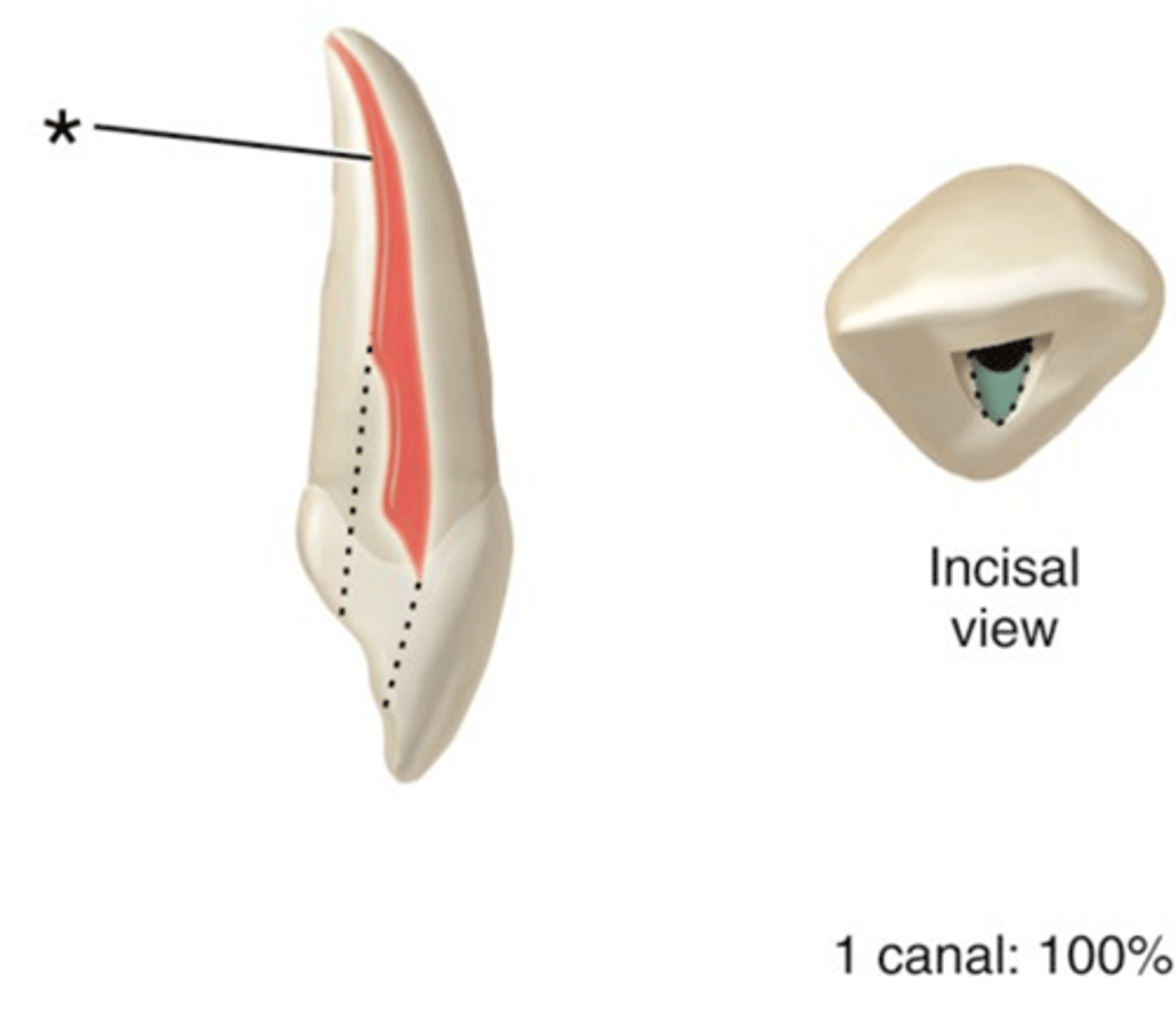 <p>Maxillary lateral incisors access shape</p>