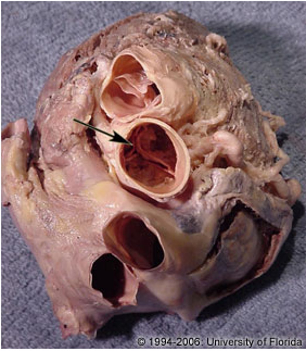 <p>Name the Structure of the Left Ventricle</p>