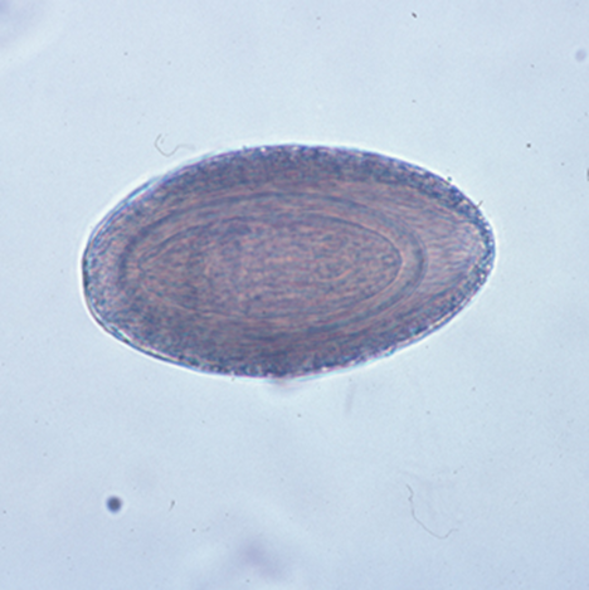 <ol><li><p>Eggs released in host feces​</p></li><li><p>Spindle shaped egg with 3 layers​</p></li><li><p>Egg contains larva acanthor​</p></li><li><p>Intermediate host: arthropod​</p></li><li><p>Acanthor hatches into ancanthella then cystoacanth with inverted proboscis​</p></li><li><p>Definitive host ingests arthropod, adult pushes out proboscis and attaches to intestine wall</p></li></ol><p></p>
