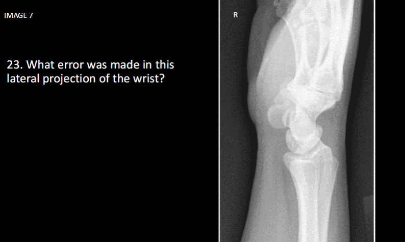 <p>What error was made in this lateral projection of the wrist</p>