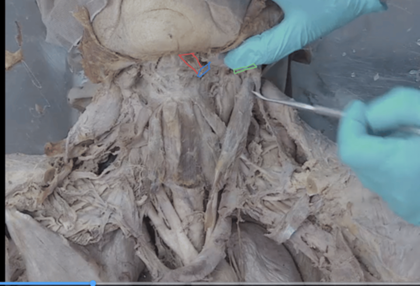 <p>what muscle is the red outline</p>