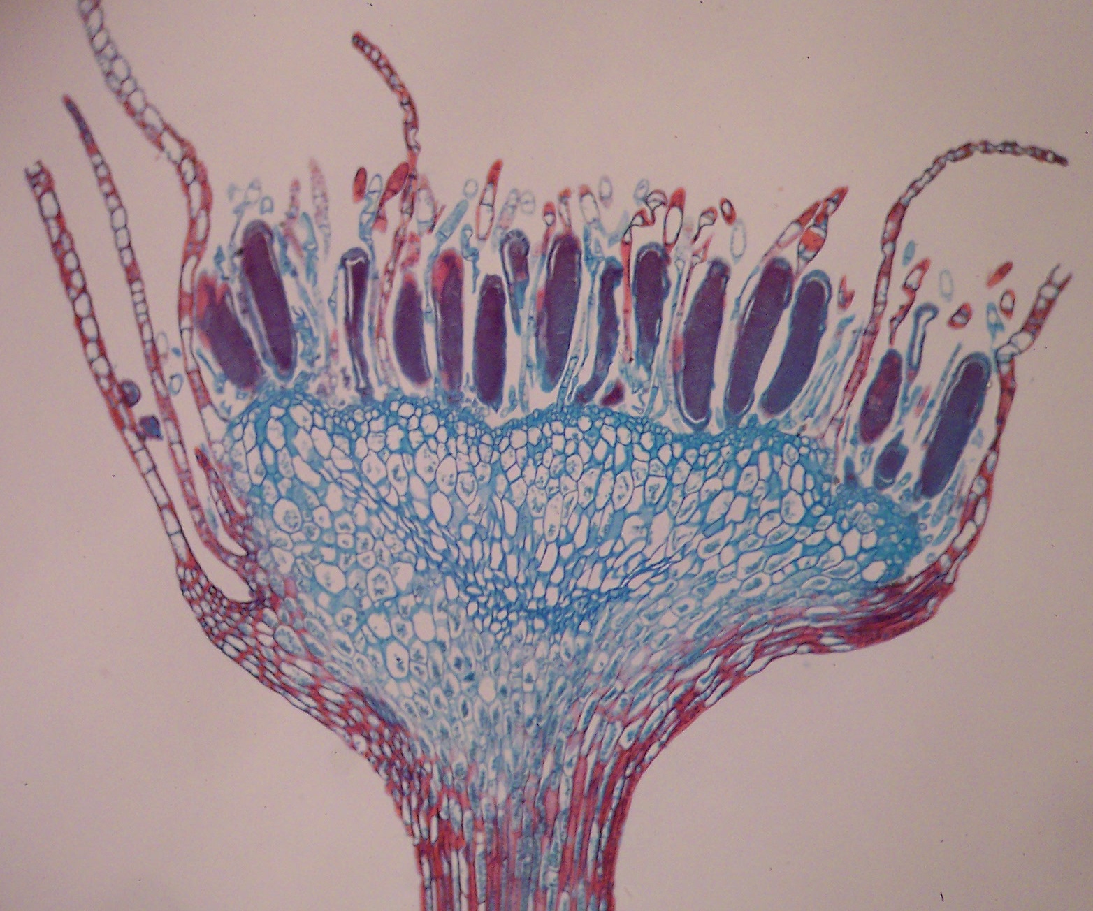 This is an archegonia/antheridia?
