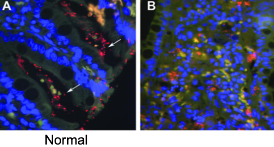 <p>FISH detect enteroinvasive e. coli by using genetic probes directed against a specific section of the DNA of e. coli that has be fluorescently labeled</p>