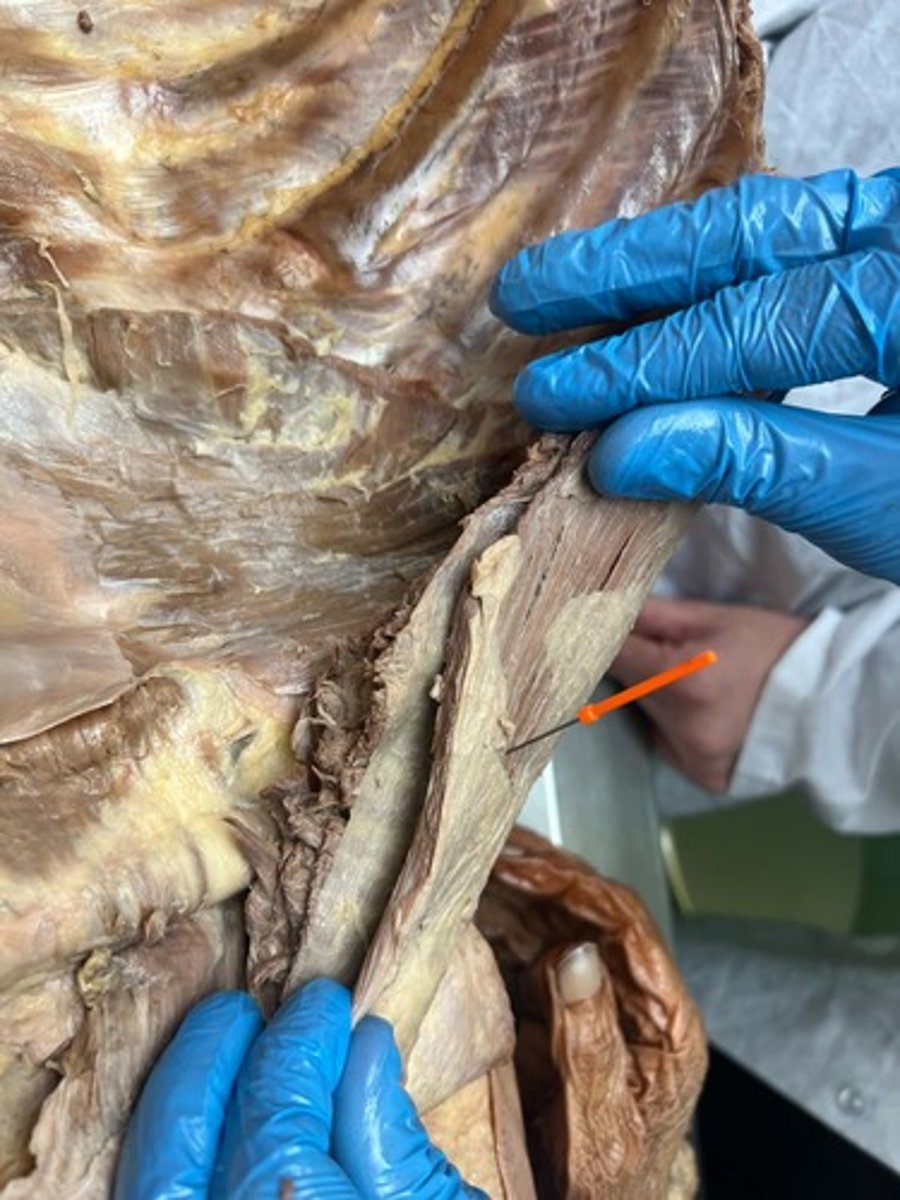 <p>external abdominal oblique muscle</p>