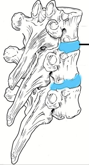 <p>Found in between adjacent vertebrae. Composed of fibrous cartilage. Help form a slightly moveable joint, facilitate movement of the spine and acts as a cushion to absorb shocks from movements such as walking and running.</p>