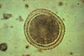 <p>What is the common name for “<em>Toxocara canis”</em> ?</p>