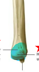 expanded distal end