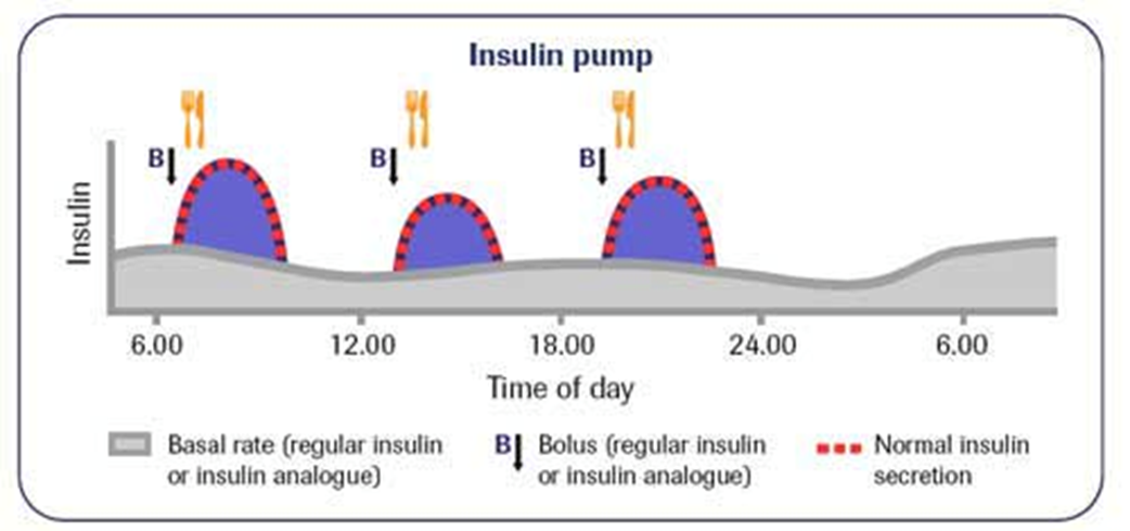<p>‘Rapid acting’ insulin in pumps: basal insulin requirements</p>