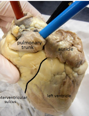 <p>What is the line that divides the heart? (black line)</p>