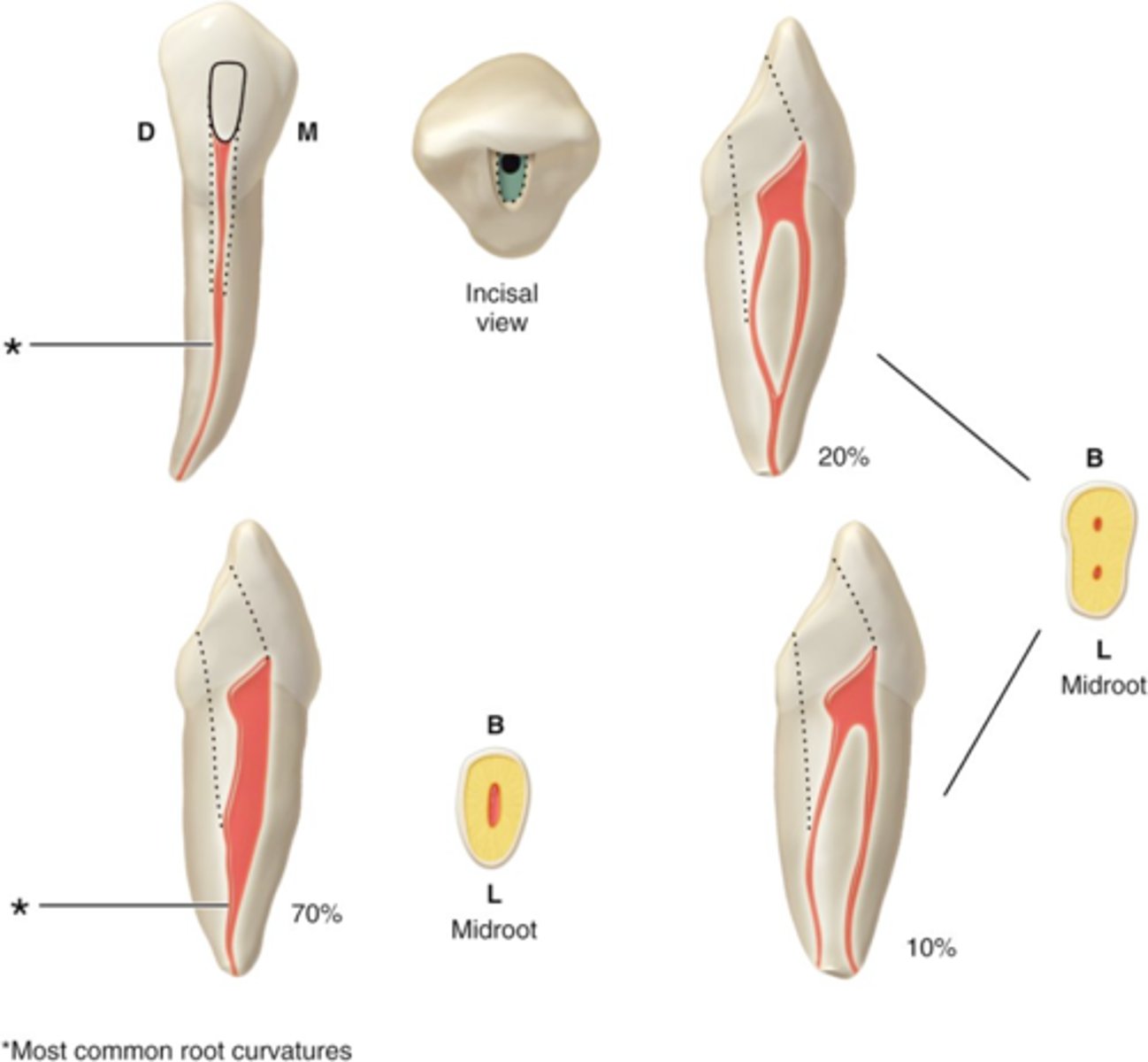 <p>mandibular canine access shape</p>