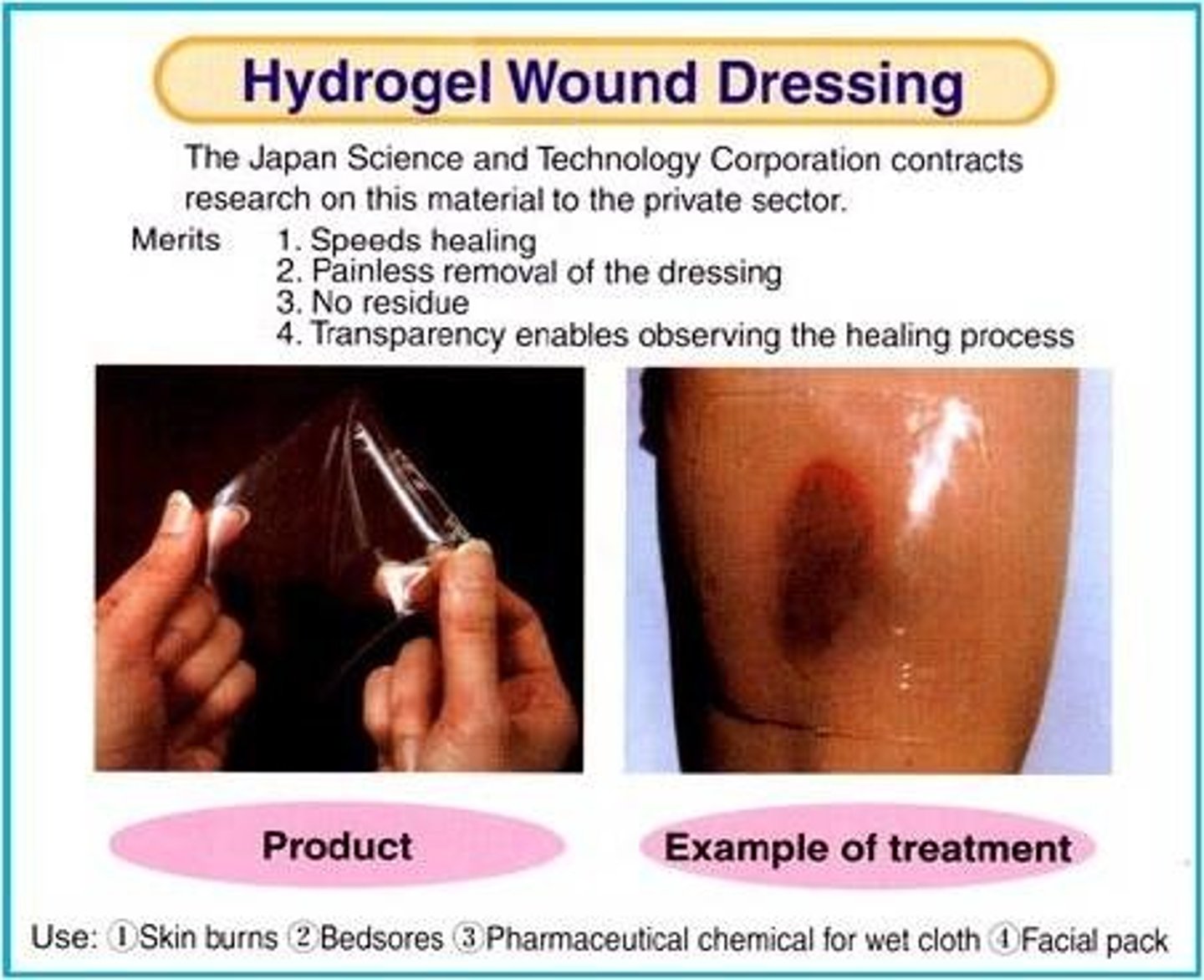 <p>-water and gel-forming materials such as glycerin</p><p>-commonly used on superficial and partial thickness wounds (abrasions, blisters,. pressure ulcers) that have MINIMAL DRAINAGE</p>
