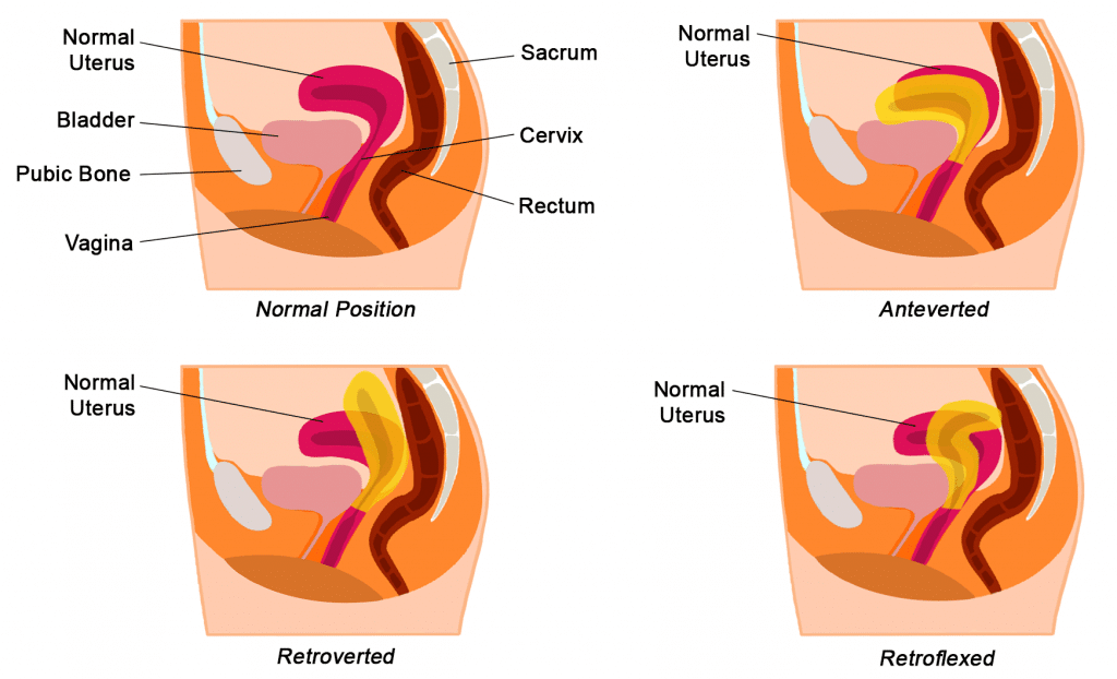 <ul><li><p><strong>Endometrium:</strong> Inner lining of the uterus; thickens for possible pregnancy and sheds during menstruation.</p></li><li><p><strong>Myometrium:</strong> Middle, muscular layer of the uterus; contracts during labor and menstruation.</p></li><li><p><strong>Perimetrium:</strong> Outer protective layer of the uterus.</p></li></ul><p></p>
