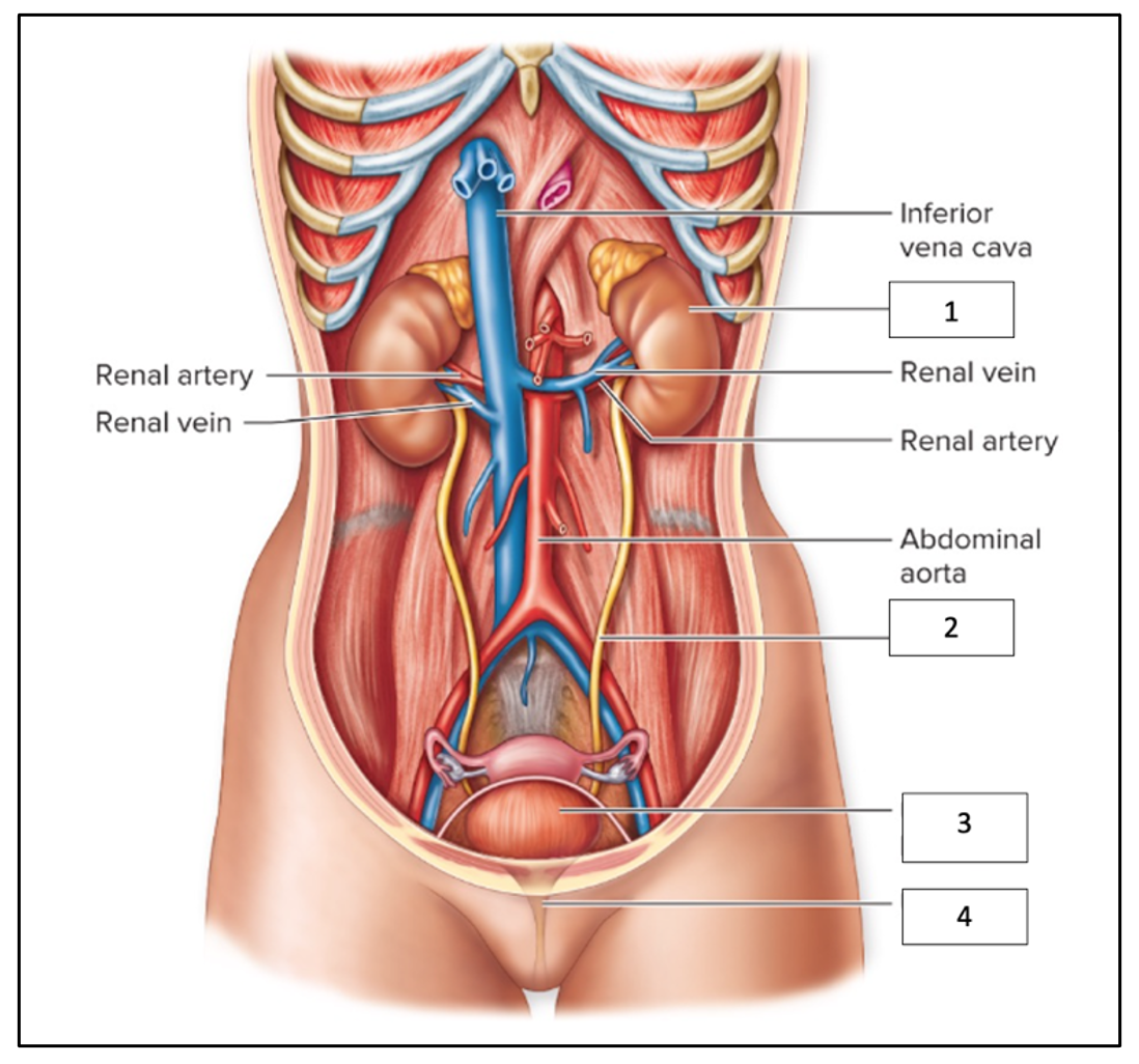 Label the following diagram:
