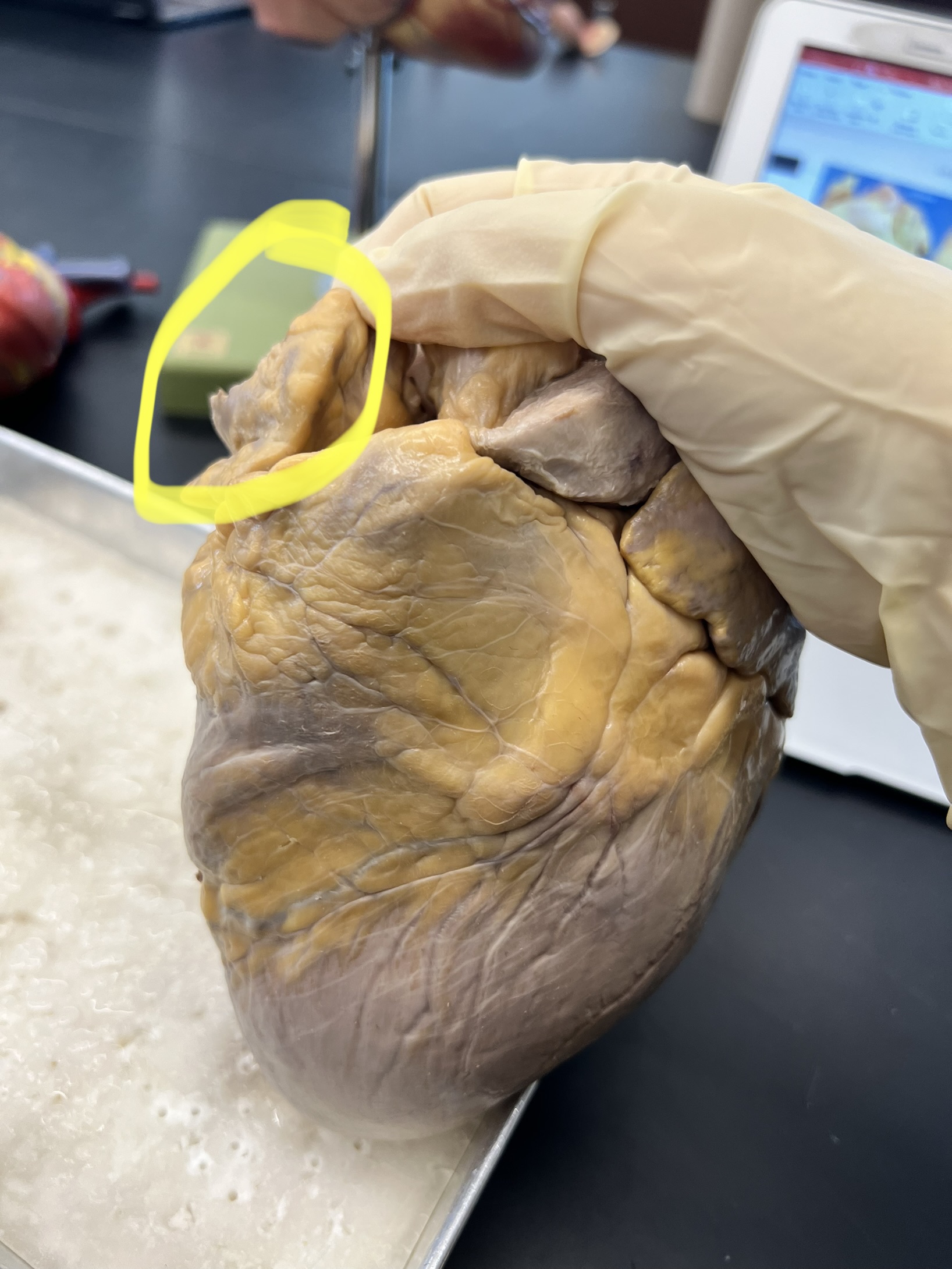 Name the heart structure.