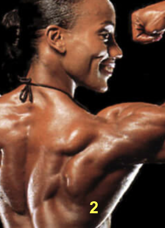 <p>What muscle is indicated by “2”?</p>