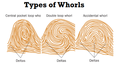 <ul><li><p>normal, central pocket, double loop, and accidental </p></li></ul><p></p>