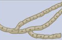 <p>Septate hyphae</p>