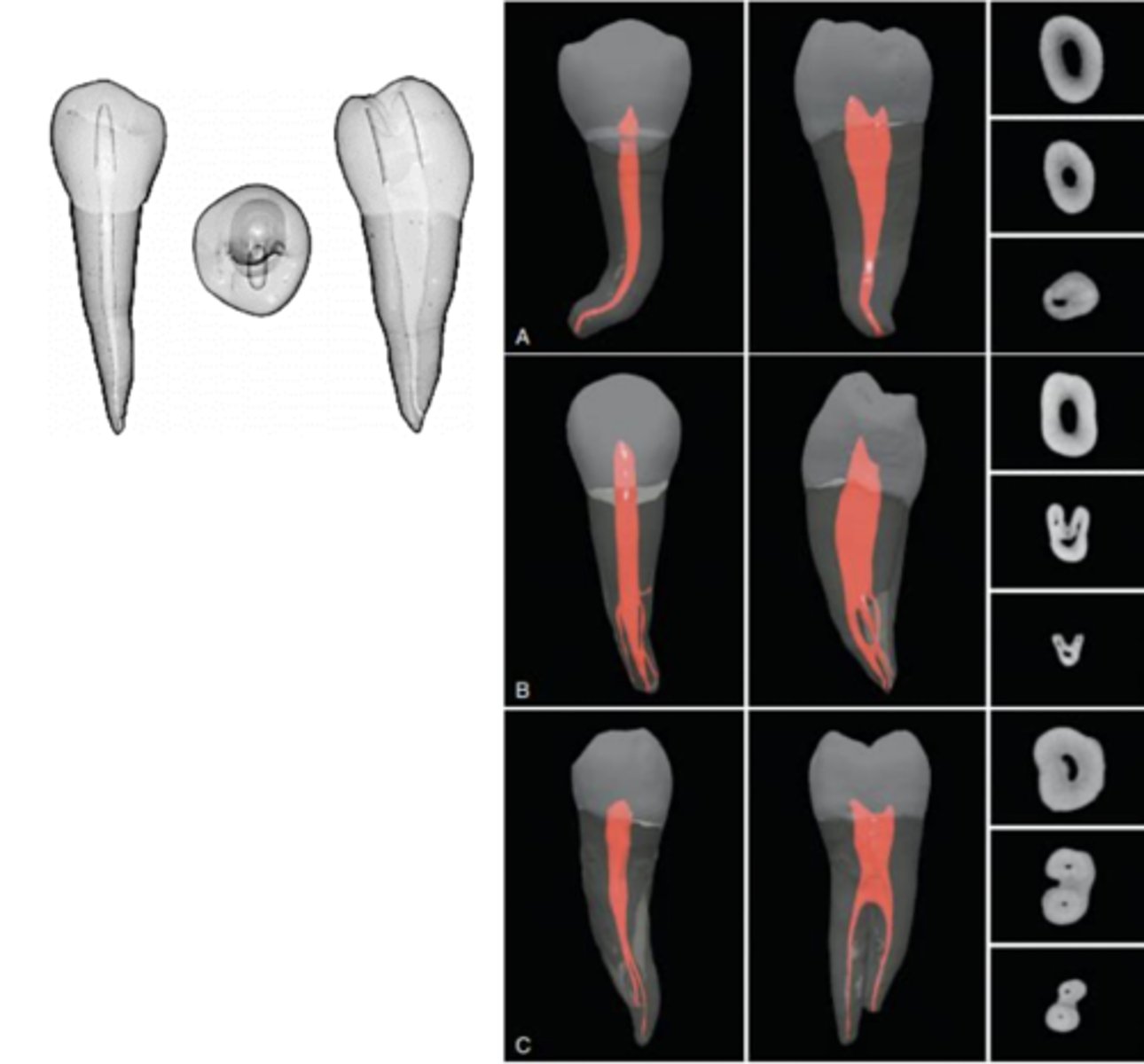 <p>mandibular 2nd premolar</p>