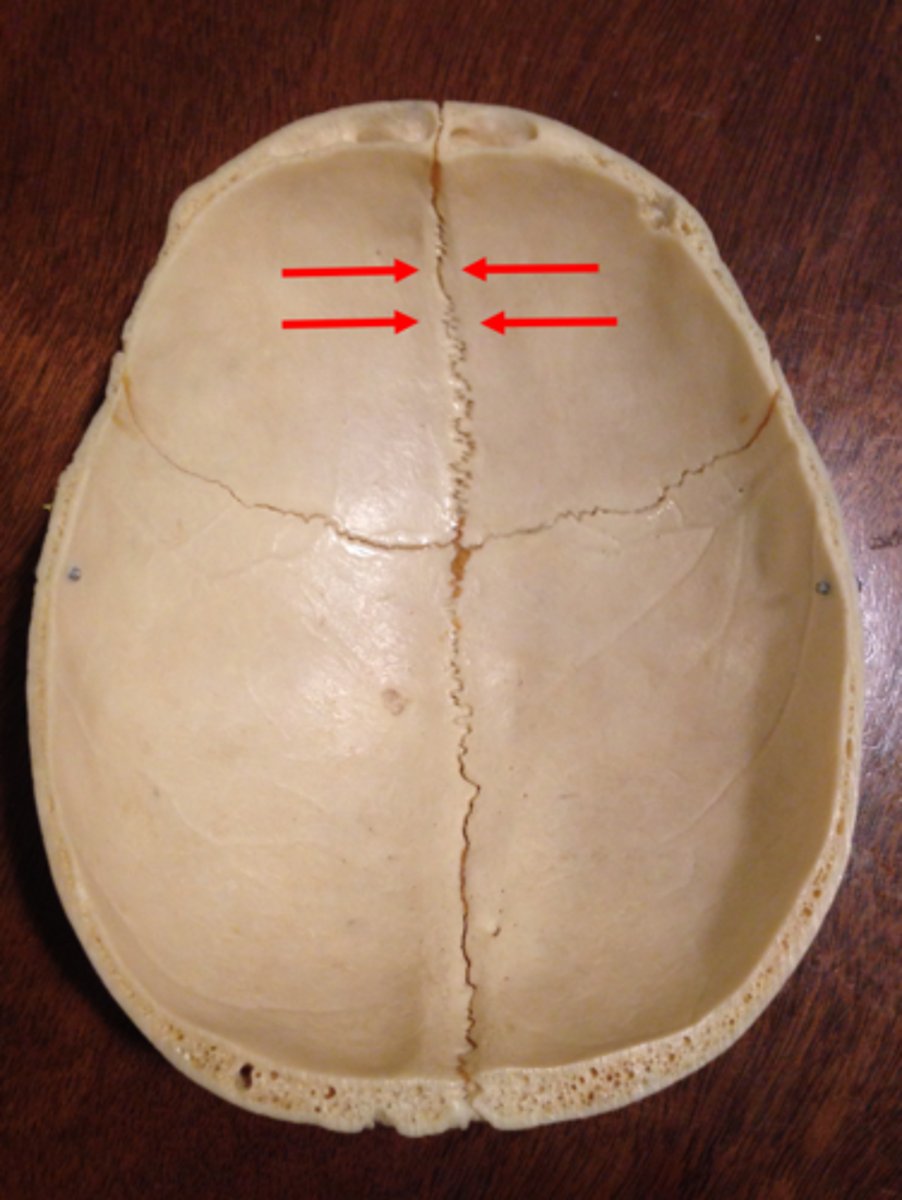 <p>vertical groove that runs down the midline of the endocranial surface</p>