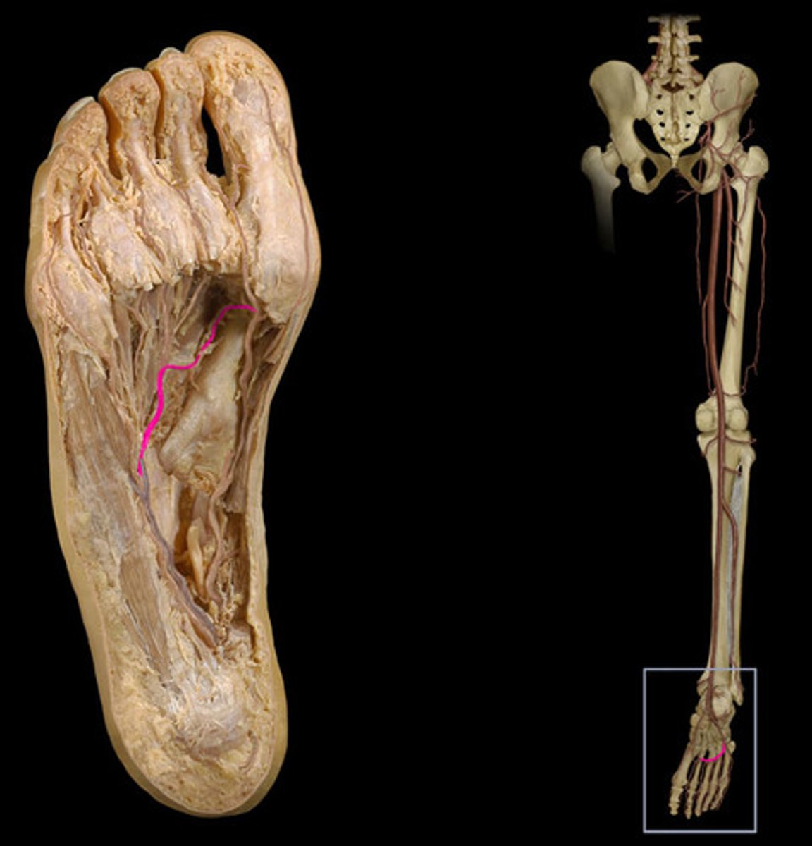<p>Passes deeply between the interosseous of the first digit, joining the lateral tarsal artery to form the deep plantar arch. Pierces between 1st and 2nd metatarsals.</p>
